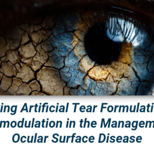 Integrating Artificial Tear Formulations and Neuromodulation in the Management of Ocular Surface Disease