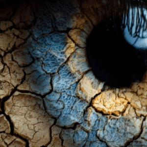 Integrating Artificial Tear Formulations and Neuromodulation in the Management of Ocular Surface Disease